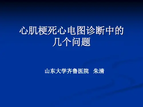 心肌梗死心电图诊剖析