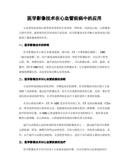 医学影像技术在心血管疾病中的应用
