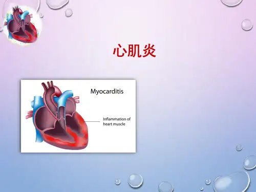 心肌炎--