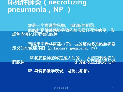 肺炎链球菌肺炎课件
