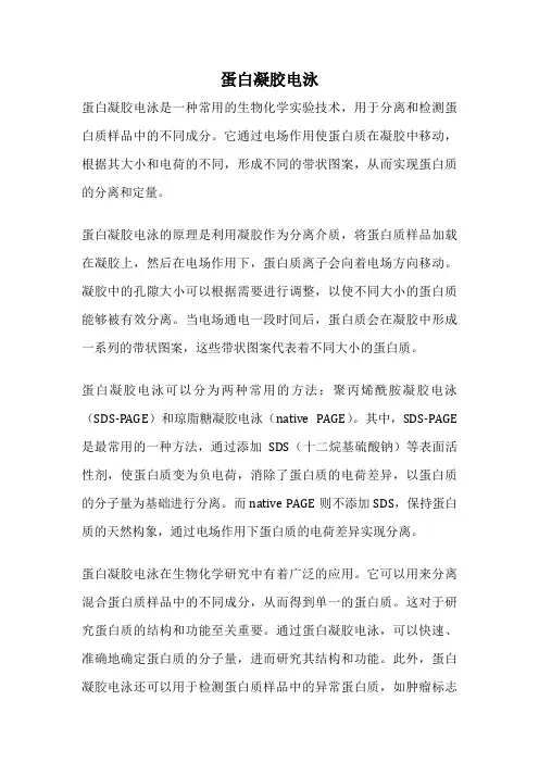 蛋白凝胶电泳