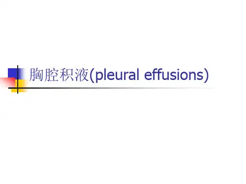 胸腔积液课件