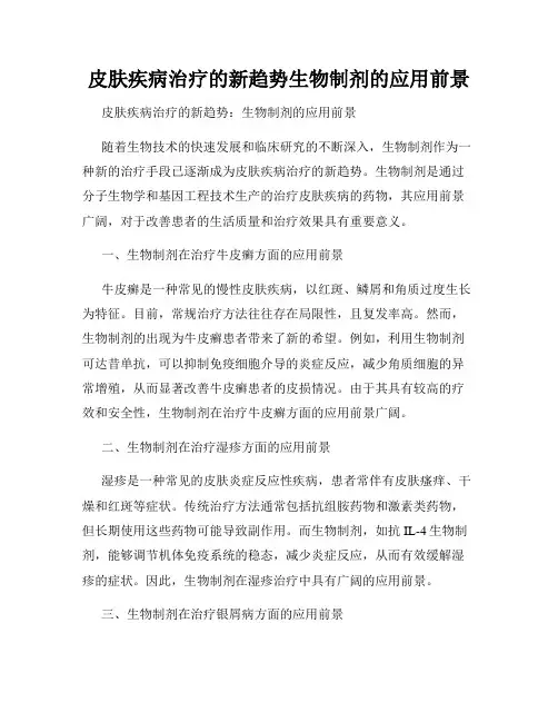 皮肤疾病治疗的新趋势生物制剂的应用前景