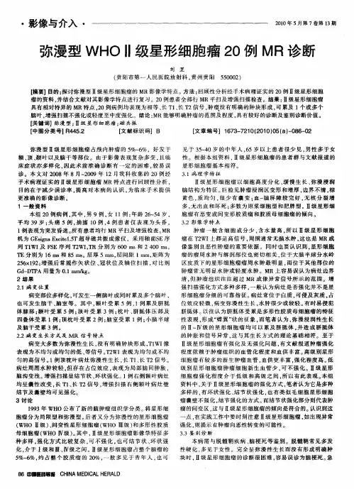 弥漫型WHOⅡ级星形细胞瘤20例MR诊断