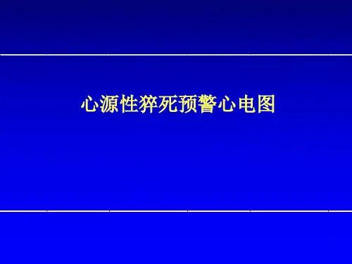 恶性室性心律失常的心电图预警