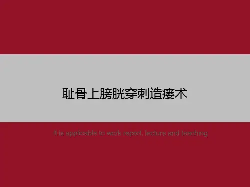 耻骨上膀胱穿刺造瘘术