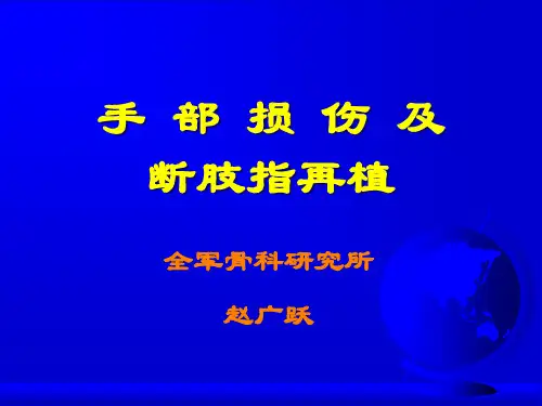 手部解剖