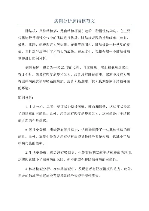 病例分析肺结核范文