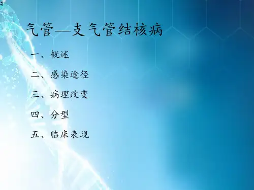 气管—支气管结核病ppt课件