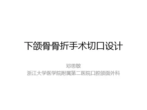 邓思敏-下颌骨骨折手术切口设计