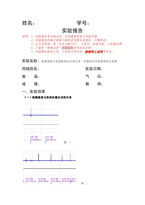【最新精选】刺激强度与肌肉收缩反应的关系／骨骼肌的单收缩和复合收缩