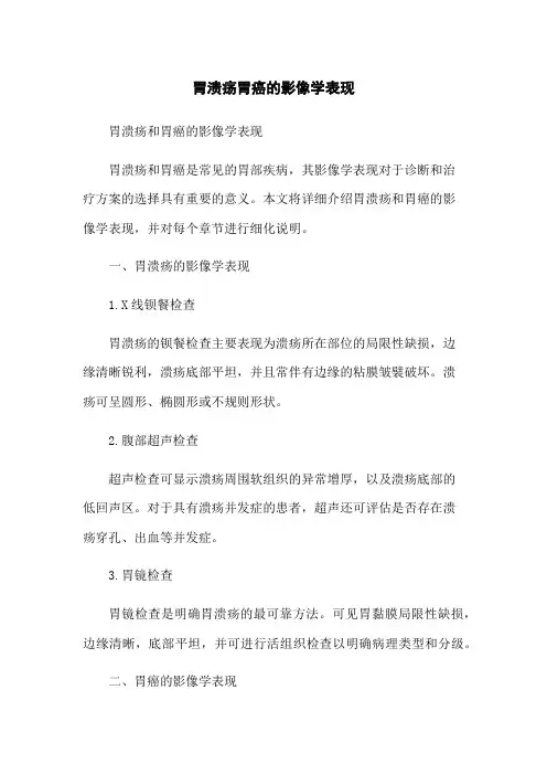 胃溃疡胃癌的影像学表现