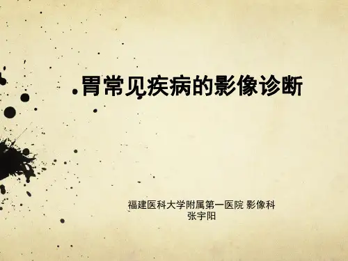 医学影像-胃常见疾病的影像诊断