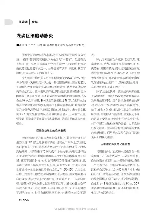 浅谈巨细胞动脉炎