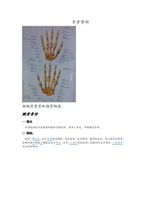 手骨骨折 课件