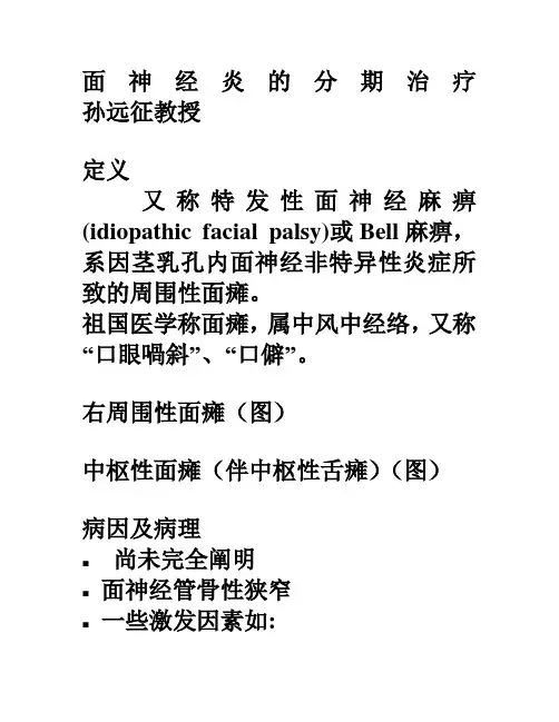 面神经炎分期治疗