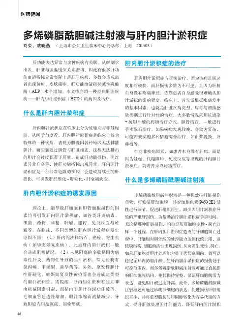 多烯磷脂酰胆碱注射液与肝内胆汁淤积症