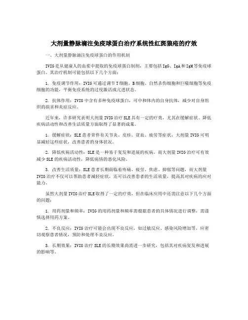 大剂量静脉滴注免疫球蛋白治疗系统性红斑狼疮的疗效