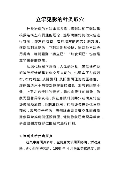 立竿见影的针灸取穴