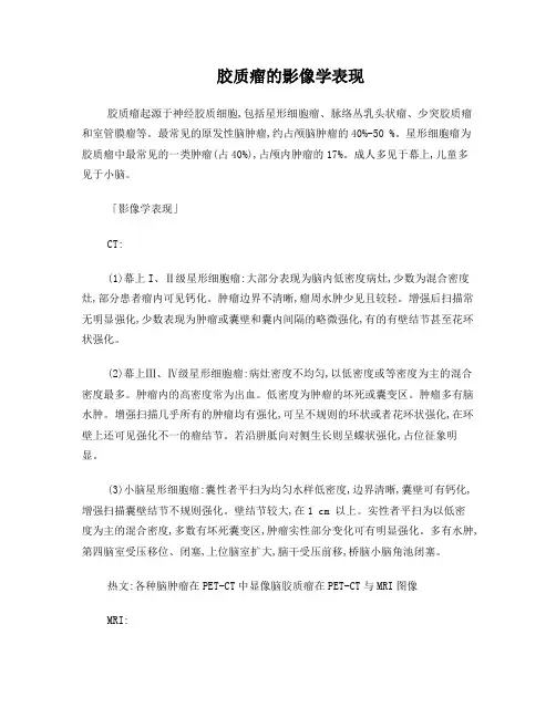胶质瘤的CT、MRI表现