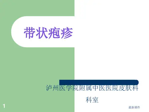 带状疱疹-精品课件PPT课件