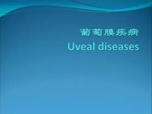 葡萄膜疾病课件