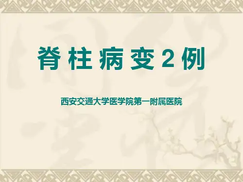 脊柱病淋巴瘤病例报告