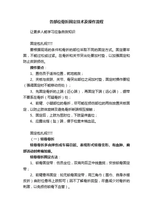 各部位骨折固定技术及操作流程