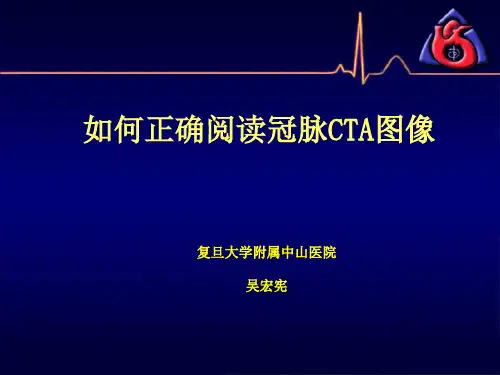 冠脉CTA读片(非常经典)ppt课件