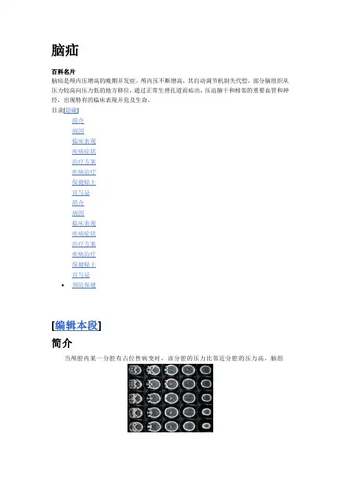 脑疝