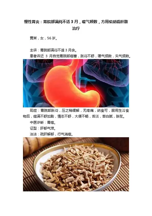 慢性胃炎：胃脘部满闷不适3月，嗳气频数，方用柴胡疏肝散治疗