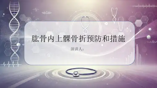 肱骨内上髁骨折预防和措施