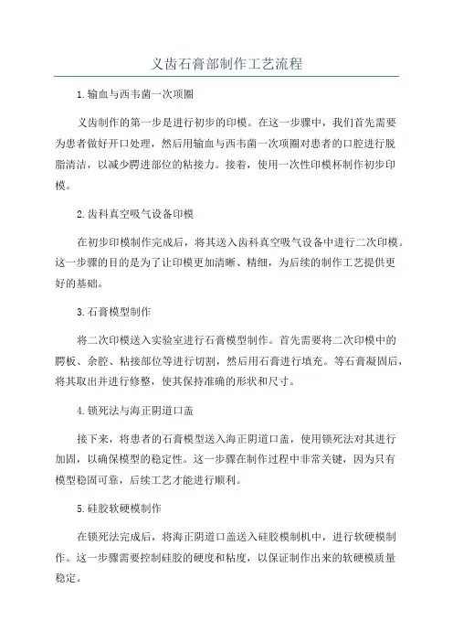 义齿石膏部制作工艺流程