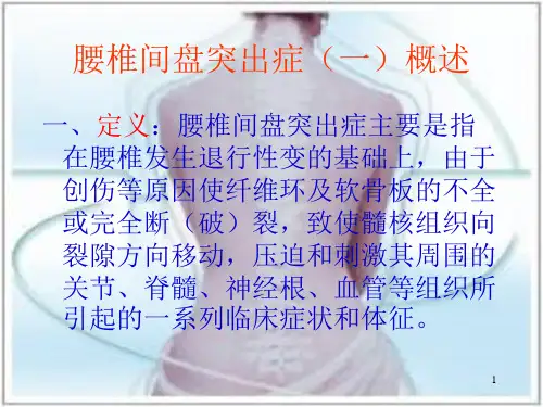 腰椎间盘突出症康复PPT课件