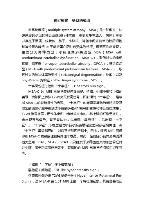 神经影像：多系统萎缩