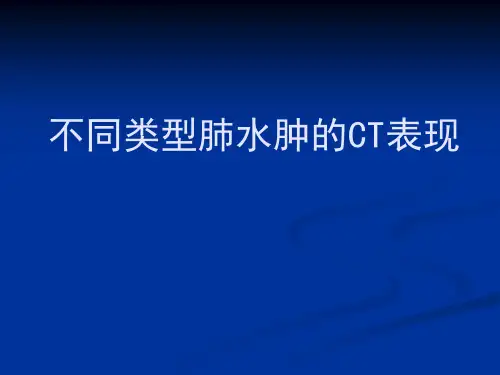 肺水肿的CT表现PPT课件