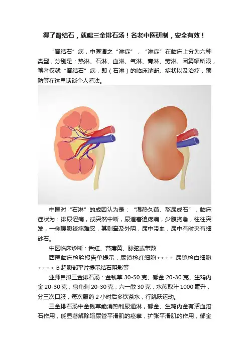 得了肾结石，就喝三金排石汤！名老中医研制，安全有效！