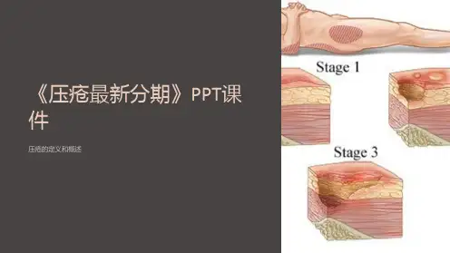 《压疮分期》课件