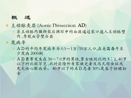 主动脉夹层PPT课件