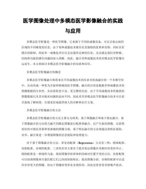 医学图像处理中多模态医学影像融合的实践与应用