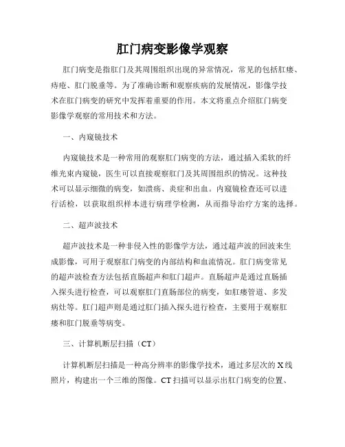 肛门病变影像学观察