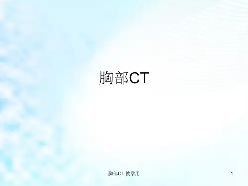 胸部CT-教学用ppt课件