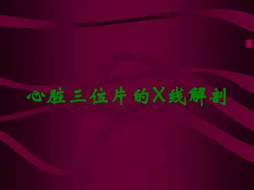 心脏三位片的X线解剖