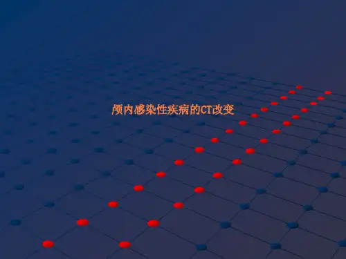 颅内感染性疾病的CT改变