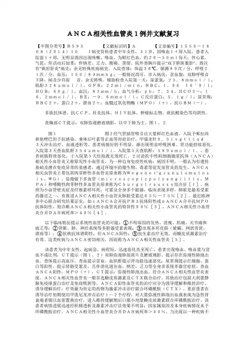 ANCA相关性血管炎1例并文献复习