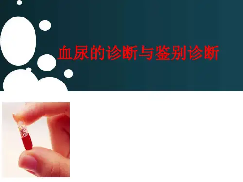 血尿【22页】