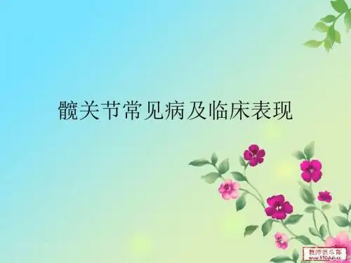 髋关节常见病及临床表现PPT课件
