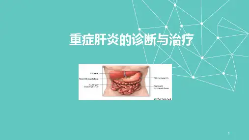 重症肝炎的诊断-PPT课件