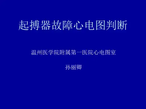 起搏器故障心电图判断