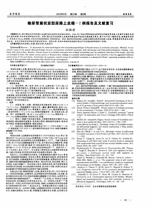 输尿管巢状亚型尿路上皮癌-2例报告及文献复习